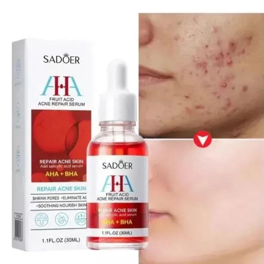 Sadoer Serum Reparador de Piel con Ácido de Frutas AHA + BHA 30ml 🍓✨ — Control de Acné y Renovación Celular